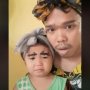 Alis Bayi Ini Bentuknya Mirip Cicak, Kok Bisa?