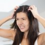 Jangan Biarkan Rambut Berketombe Bikin Gerah Saat Berpuasa, Baca Pemicunya