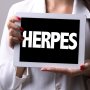 Ketahui, 5 Fakta dan Mitos Seputar Penyakit Seksual Herpes Genital