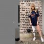 Satu Kakinya Diamputasi, Perempuan Ini Justru Sukses jadi Model
