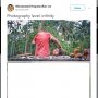Cuma Tipuan Kamera, Foto Anak yang Dimutilasi Ini Bikin Takjub Warganet