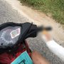 Patah Tulang Tangan Kanan, Trik Unik Naik Motor Ini Bikin Salah Fokus