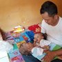 Tolong... Bayi Kembar Siam Ini Lahir Dengan Jantung dan Hati Menyatu