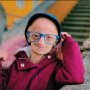 Wanita 20 Tahun Ini Terlihat seperti Nenek-Nenek, Mengapa Demikian?