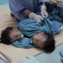 Aqila dan Azila Kembar Siam Asal Kendari