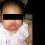 Digendong Sembarang Orang, Bayi 5 Bulan Derita Infeksi Kulit Parah!