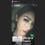 Cara Mencegah Alergi Pasca Anestesi Seperti yang Dialami Jessica Iskandar!