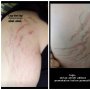 Jangan Mudah Tergiur, Efek Samping Lotion Pemutih Abal-abal Tak Bisa Hilang