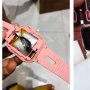 Pakai Smartwatch KW dan Meledak, Tangan Anak Ini Terbakar