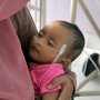 Bayi Korban Kabut Asap Dirawat di RSUD Petala Bumi Pekanbaru