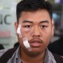 Mahasiswa Korban Ricuh Aksi DPR Mengaku Tertembak Peluru Karet