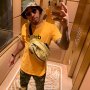 Tampil Lebih Macho, Lewis Hamilton Diduga Transplantasi Rambut