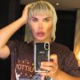 Obsesi Operasi Plastik, Rodrigo Alves: Dulu Keinginan, Sekarang Kebutuhan