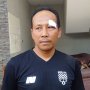 Derby Mataram Ricuh, Asisten Pelatih Persis Solo Dapat 3 Jahitan