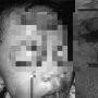 Dahi Anak Terbelah Akibat Tragedi di Taman Bermain, Ibu: Saya Akan Lawan!