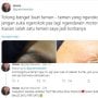 Viral Wanita Pejalan Kaki Kena Bara Rokok Pemotor, Matanya Jadi Merah