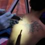 Hapus Tato dengan Laser Seperti Nathalie Holscher, Adakah Efek Sampingnya?