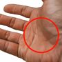 Tanda X di Telapak Tangan, Apa Maknanya? Ikuti Tes Kepribadian Ini
