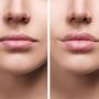 Tes Kepribadian: Bercerminlah, Seperti Apa Bentuk Bibir Anda?