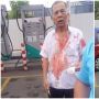 Potong Antrean di Pom Bensin, 2 Sopir Taksi Berkelahi hingga Tewas