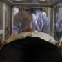 Nenek 90 Tahun Tolak Ventilator Agar Bisa Digunakan pada Pasien Muda