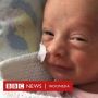 Bayi Prematur Usia Tiga Minggu Terjangkit Corona, Ini Kisah Kesembuhannya