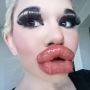 Lakukan Filler 20 Kali, Perempuan Ini Mengaku Cintai Bibir Tebalnya