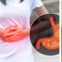 Catat! Ini 8 Jenis Makanan Bantu Cepat Turunkan Asam Lambung
