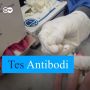 Tes Antibodi dan Pelacakan Kontak, Cara Jerman Cegah Gelombang Kedua Corona