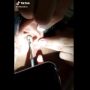 Pengguna Earphone Waspadalah! Video Earbud Nyangkut di Telinga Bikin Ngilu