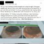 Viral Curhat Eks Anak Kos Divonis Dilarang Makan Mie Instan Seumur Hidup