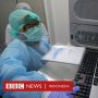 Penyandang Autoimun di Tengah Aksi Borong Klorokuin saat Covid-19