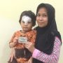Ferlys Percayakan JKN-KIS untuk Pengobatan Anaknya