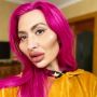 Ngaku Eksotis, Wanita Ini Pamer Wajah Ekstrem Setelah Suntik Filler Sendiri