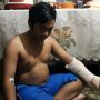 Tetangga Urunan Biayai Pengobatan Pemuda Tebet Korban Pembacokan