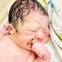 Bayi Ini Keluar dari Rahim Ibunya Sambil Pegang Alat Kontrasepsi