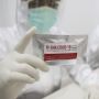 Kemenkes Jelaskan Rincian Biaya Rapid Test Antibodi