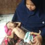 Miris, Bayi 4 Bulan Idap Sakit Paru-paru hingga Kurus Kering