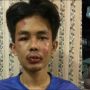 Dokter RSJ Kurungan Nyawa Ikut Periksa Kejiwaan Penusuk Syekh Ali Jaber