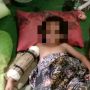 Tak Punya BPJS, Bocah 5 Tahun Terpaksa Tahan Rasa Sakit karena Patah Tulang