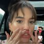Viral Prank Filler Bibir di TikTok, Ternyata Cuma Pakai Lem Bulu Mata