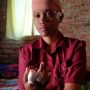 Kasus KDRT di Kabupaten Bandung Melonjak selama Pandemi Covid-19