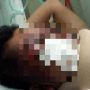 Pria Penuh Luka Korban Begal di Sukodono Ditemukan Sekarat di Semak-Semak