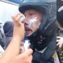 Gas Air Mata Ditembakkan, Demonstran di Jogja Bantu Polisi Oles Pasta Gigi