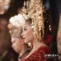 Wajah Banyak Jerawat, Nikita Willy: Rasanya Malu Ketemu Sama Orang