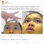Wajah Gadis Menguning karena Masker Kunyit, Warganet Beri Saran Menggelitik