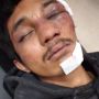 Polisi Tangkap Pengeroyok Ketua Mahasiswa Ilmu Komunikasi