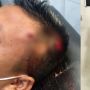 Aniaya Pakai Airsoft Gun, Sopir Truk di Bantul Terancam Bui hingga 7 Tahun