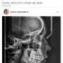 Beredar Foto Rontgen Sophia Latjuba, Publik Kagum Lihat Tulangnya