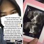 Viral Kisah Perempuan Telat Haid Selama 10 Bulan, Ternyata Karena Ini